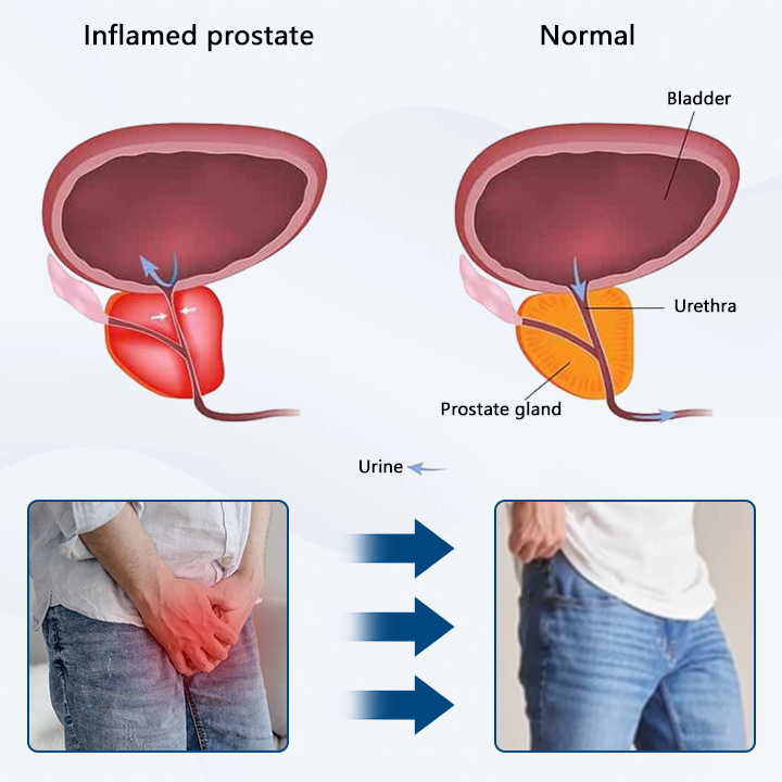 FLYCARE™ Magnetic Copper Prostate Boost Band