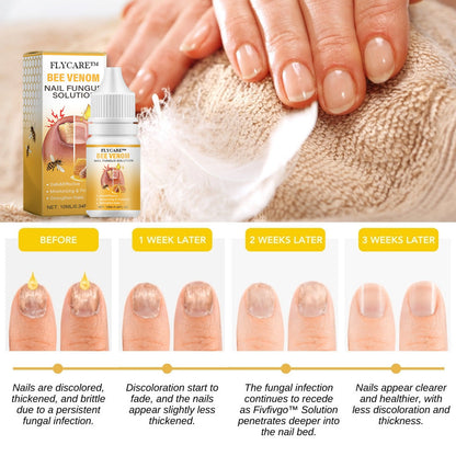 FLYCARE™ BeeVenom Nail Fungus Solution