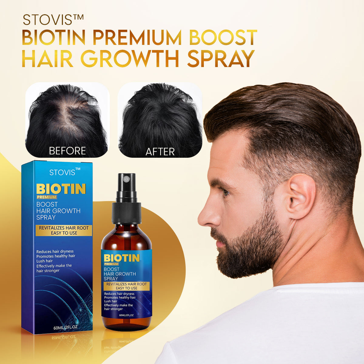 Stovis™ Biotin Premium Boost Hair Growth Spray ⏰ SALE ENDS IN 10 MINUTES ⏰